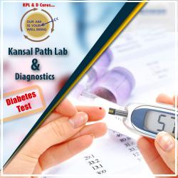Check out Full Blood test for diabetes in Yamuna vihar, Delhi