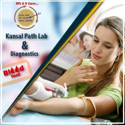 Choose Best Online lab test diagnostic center in yamuna vihar, Delhi